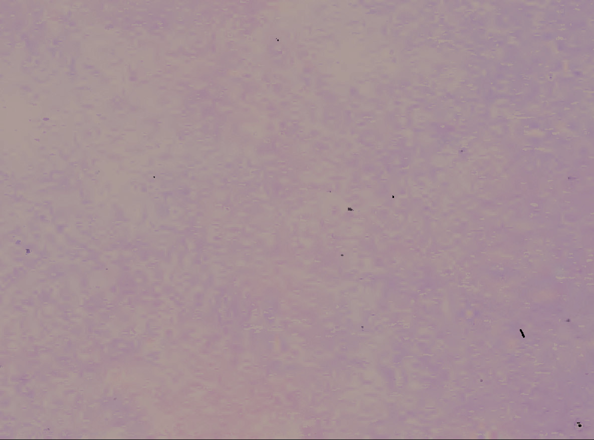 land- und forstwirtschaftlich genutztes Grundstück in Ockstadt - Bild 1